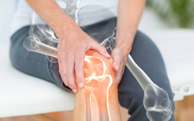 Top Tips for Managing Arthritis Pain From a Physiotherapist